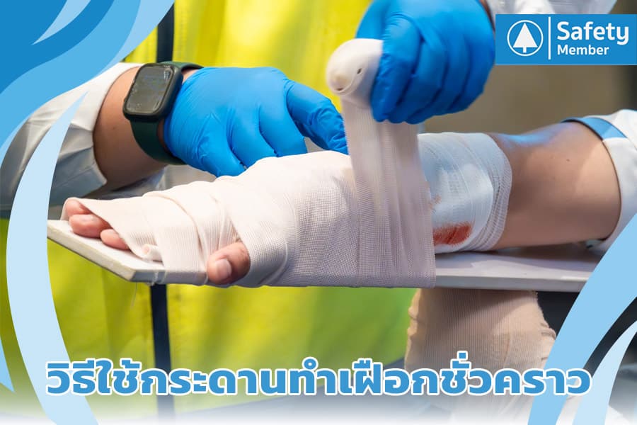 วิธีใช้กระดานทำเฝือกชั่วคราว