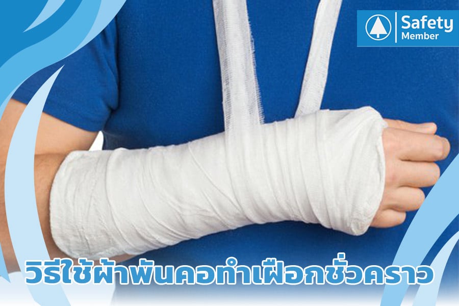 วิธีใช้ผ้าพันคอทำเฝือกชั่วคราว
